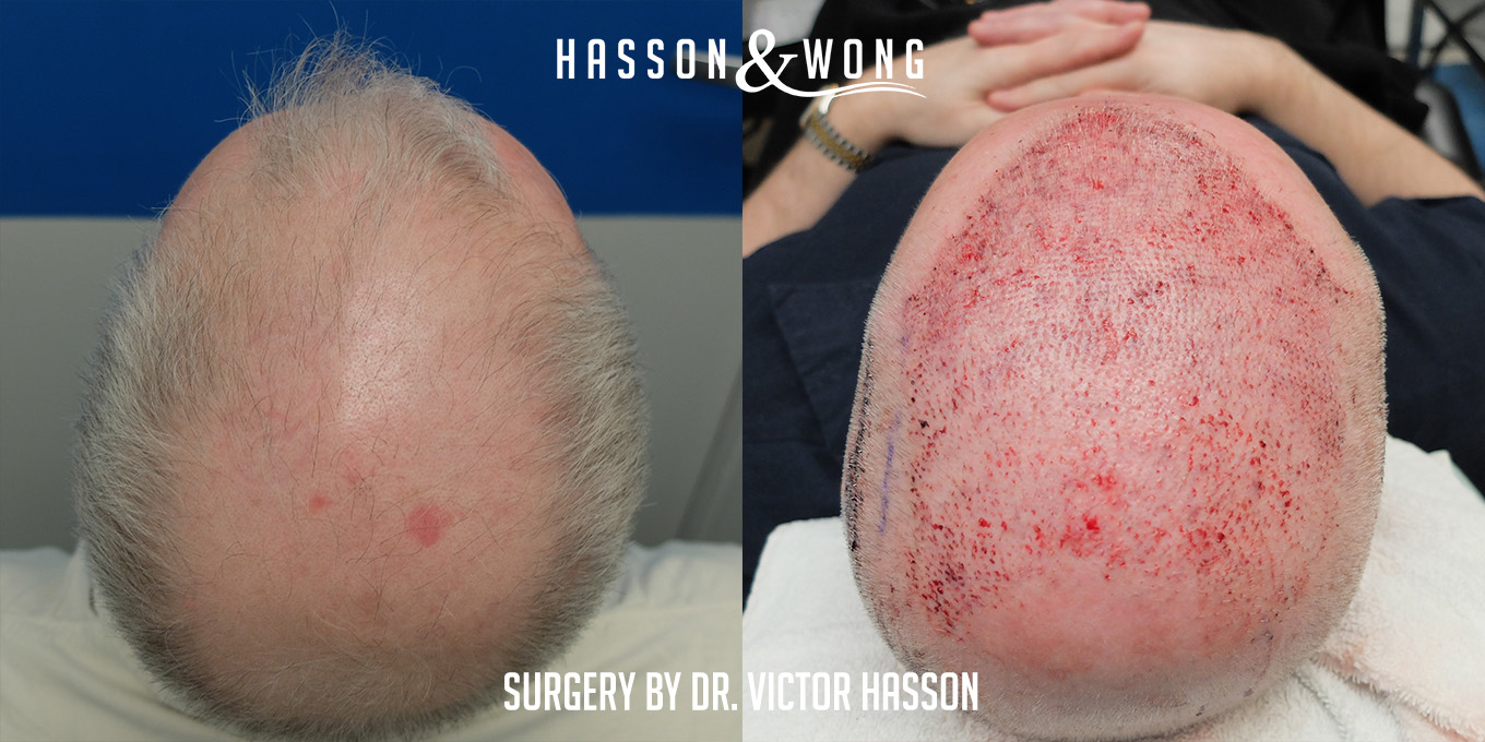 JDH-DR.Hasson-befor-after.jpg