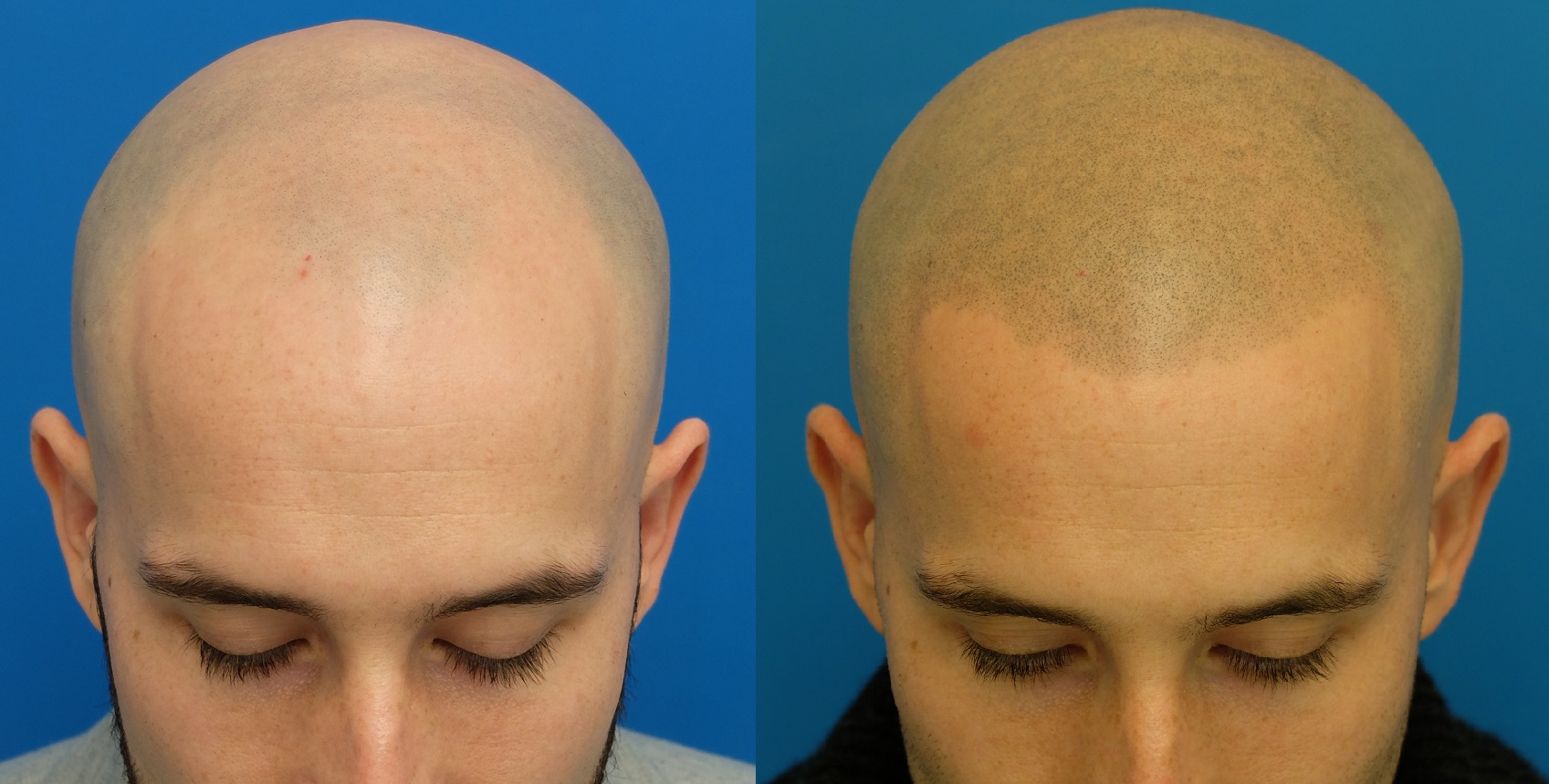 Shaved head before and after engine